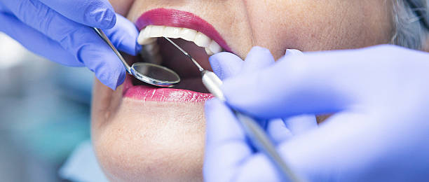 Best Emergency Treatment for Dental Infections or Abscesses in Cedar Grove, WI